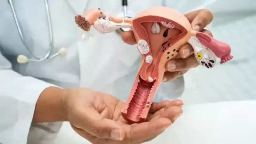 cervical cancer 1738067338379 1738067371279