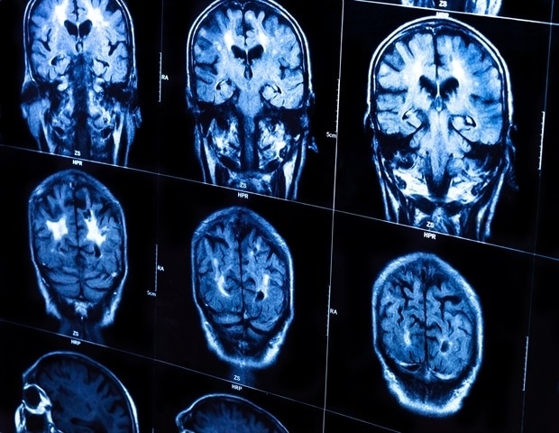 Nova 3D tehnologija snimanja mogla bi revolucionirati medicinsku dijagnostiku.