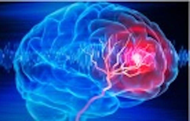Promjene u načinu života mogu utjecati na Alzheimerovu bolest