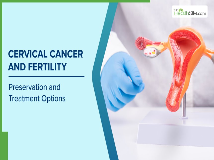 Cervical Cancer Protecting Fertility And Health