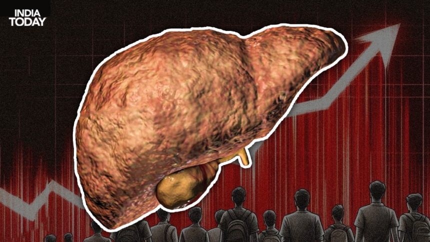 fatty liver is becoming the next epidemic in india photo getty imagevani guptaindia today 063813417