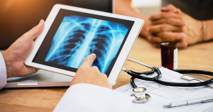 Ja sam kardiolog: Ova životna navika jednako šteti vašem zdravlju kao i pušenje