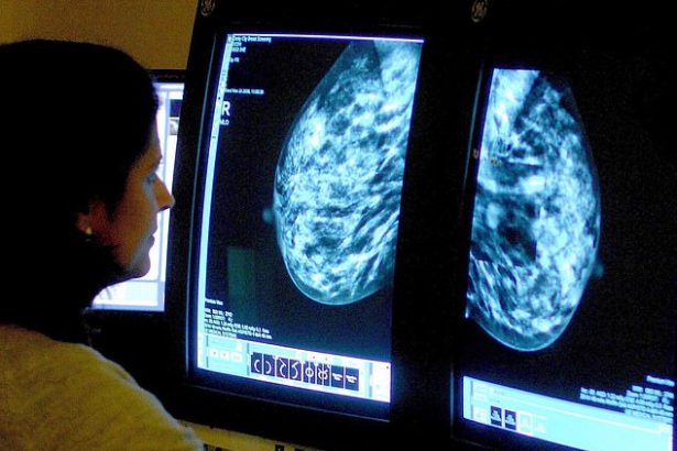 Istraživači otkrivaju ključni uzrok koji povećava rizik od smrtnosti od raka dojke kod 80% žena