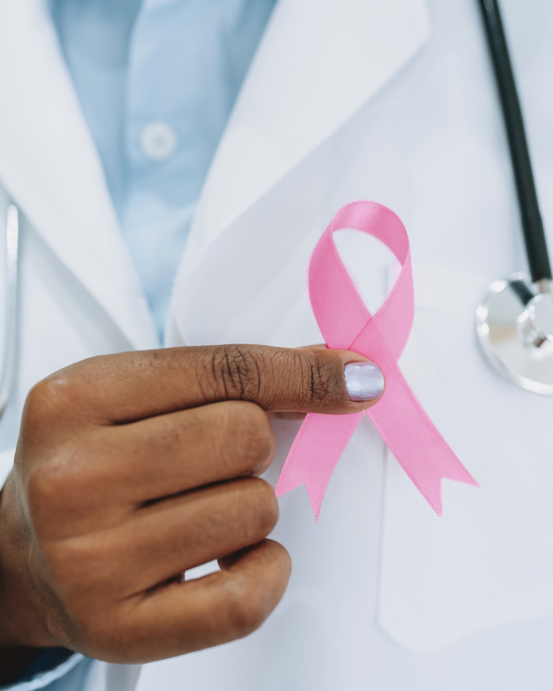Nova tehnologija snimanja pomaže kirurzima iz Stanford Medicine u smanjenju ponovljenih operacija dojke