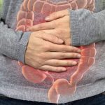 Alarmantan porast raka crijeva kod mladih: iznenađujući uzroci koji potiču epidemiju