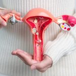 Dijeta plodnosti može značajno utjecati na žene s endometriozom, tvrdi stručnjak.