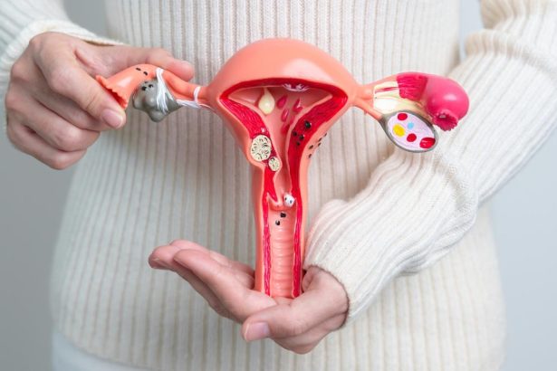 Dijeta plodnosti može značajno utjecati na žene s endometriozom, tvrdi stručnjak.