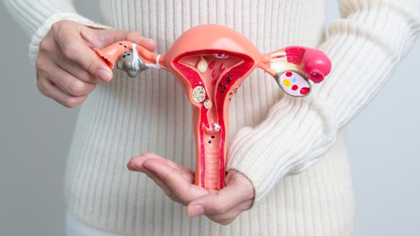 Dijeta plodnosti može značajno utjecati na žene s endometriozom, tvrdi stručnjak.
