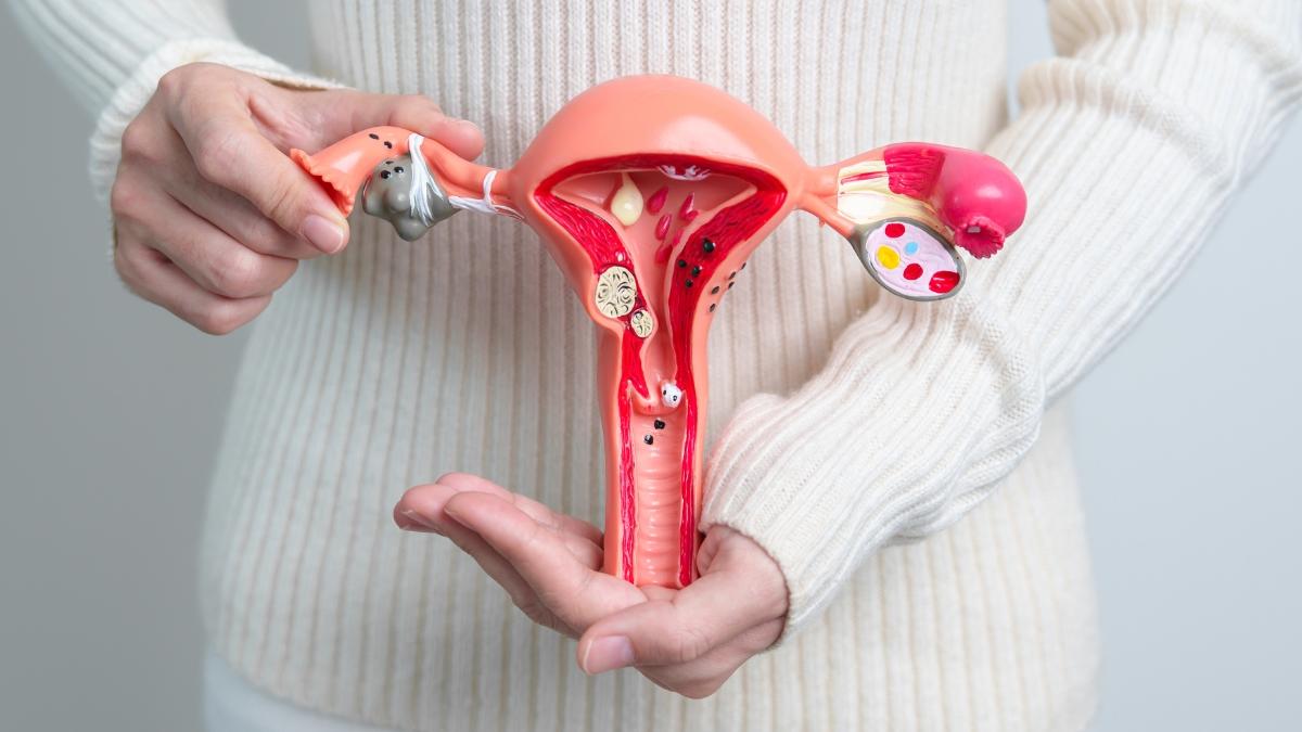 Dijeta plodnosti može značajno utjecati na žene s endometriozom, tvrdi stručnjak.