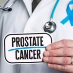 Rak prostate: uzroci, simptomi, faktori rizika i zdrave navike za prevenciju