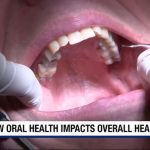 Važnost oralne zdravstvene njege za očuvanje zdravog načina života i prevenciju većih problema