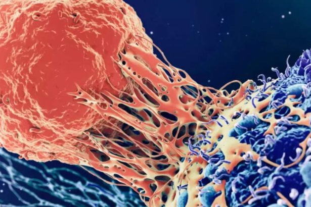 Zdrave životne navike: Vrhunski kardiolog s Floride otkriva 4 pravila za prevenciju raka, bolesti srca i dijabetesa