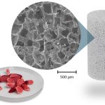 Tehnologija regeneracije kosti primijenjena u operaciji prvog pacijenta