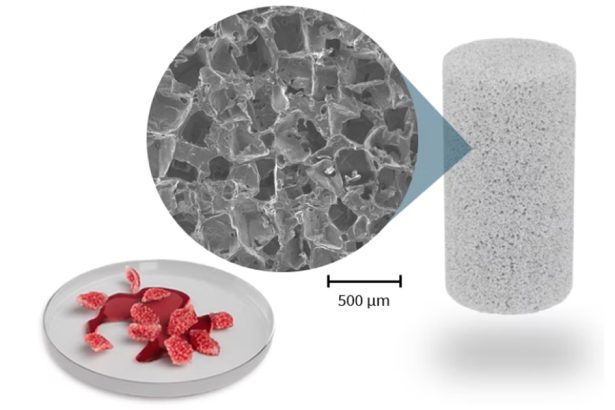 Tehnologija regeneracije kosti primijenjena u operaciji prvog pacijenta