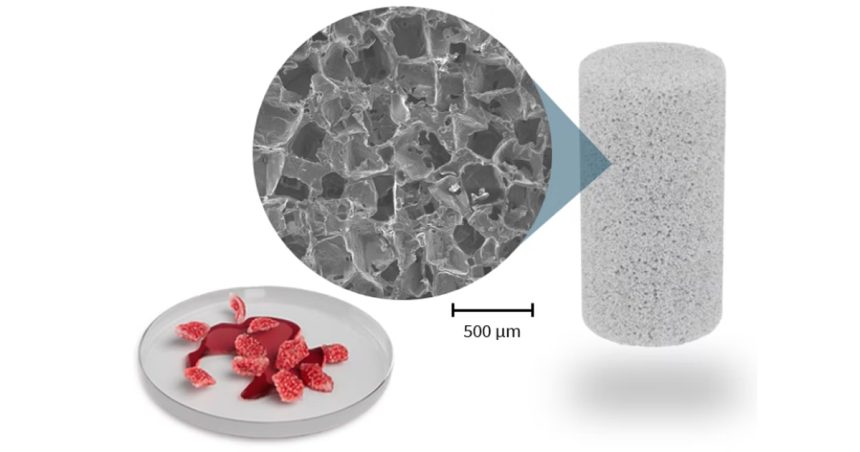 bone regeneration technology used in first patient surgery social