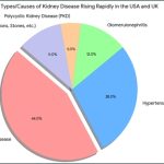 Chronic Kidney Disease Increasing Sharply in the USA and UK: Experts Attribute It to Lifestyle, Diet, and Metabolic Disorders