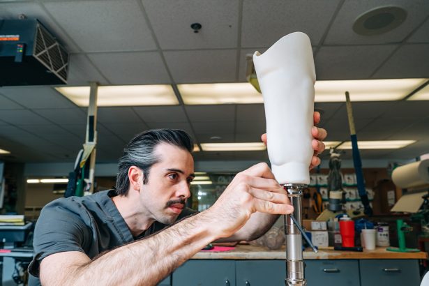 UAB Amputee Clinic Pioneers 3D-Printed Prosthetic Technology in Alabama