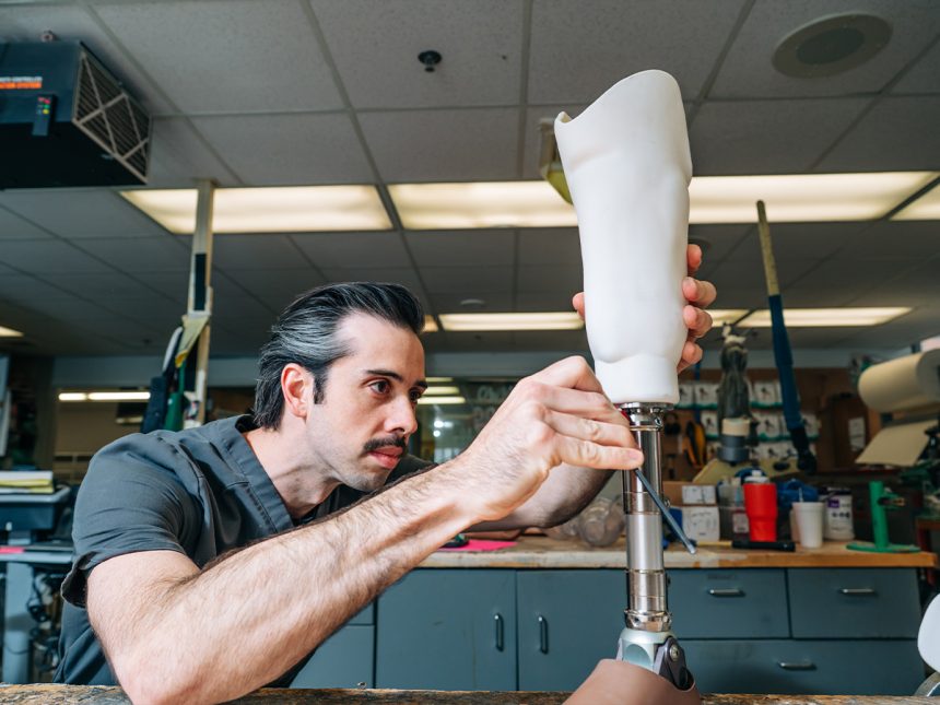 UAB Amputee Clinic Pioneers 3D-Printed Prosthetic Technology in Alabama