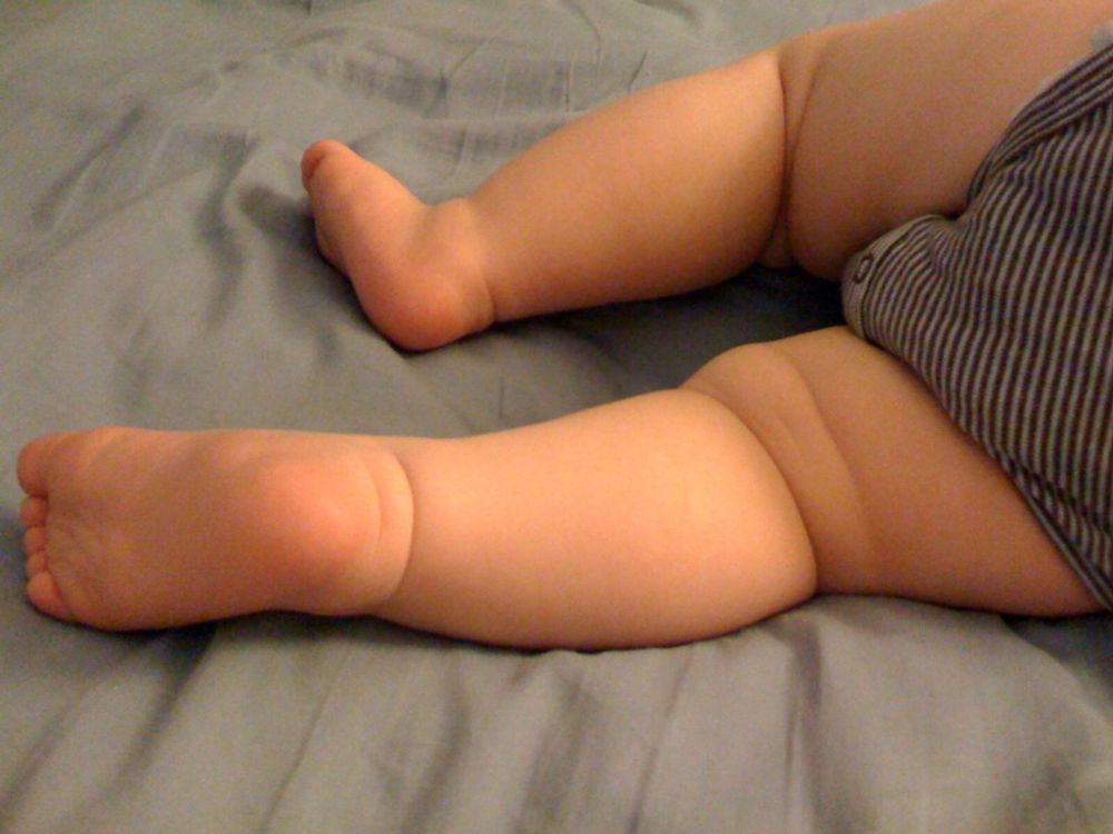 Gauteng Health Department Introduces Program to Combat Childhood Obesity